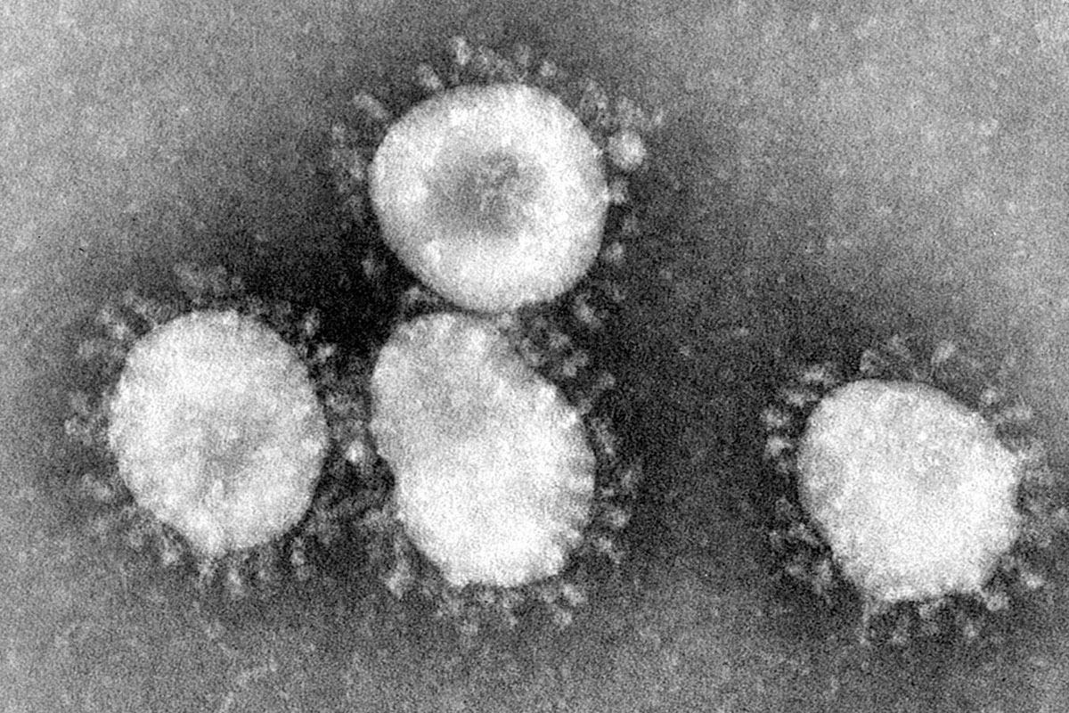 Coronavirus félin FCov